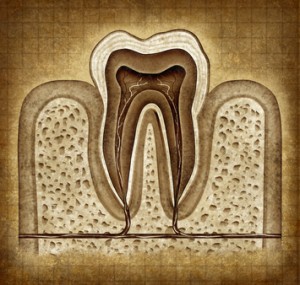 Are Root Canals Safe?